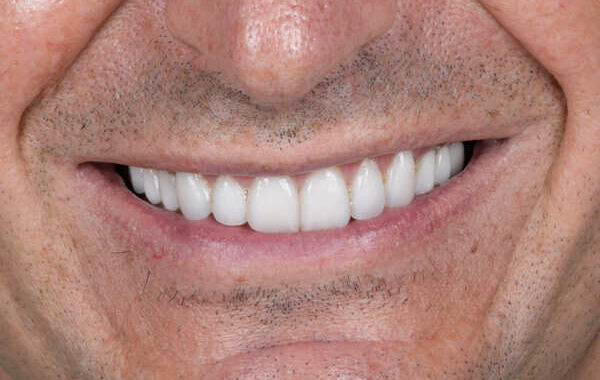 ..